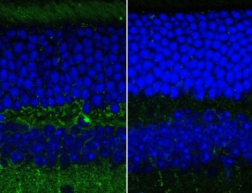 OCT-Based Imaging Technology Detects Alzheimer’s in Mice